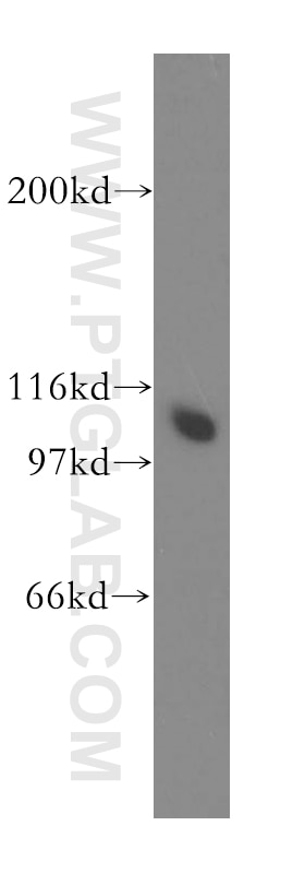 Western Blot (WB) analysis of mouse ovary tissue using MCM6 Polyclonal antibody (13347-2-AP)