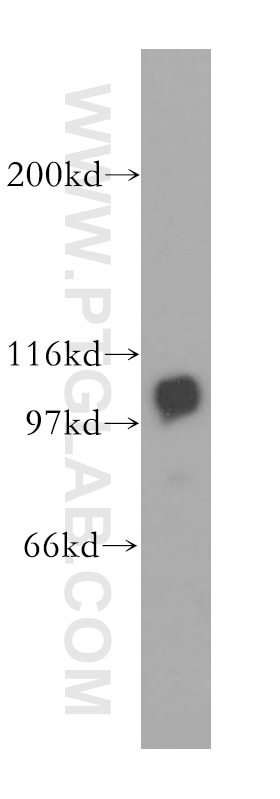Western Blot (WB) analysis of mouse thymus tissue using MCM6 Polyclonal antibody (13347-2-AP)
