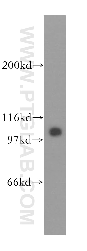 Western Blot (WB) analysis of mouse spleen tissue using MCM6 Polyclonal antibody (13347-2-AP)