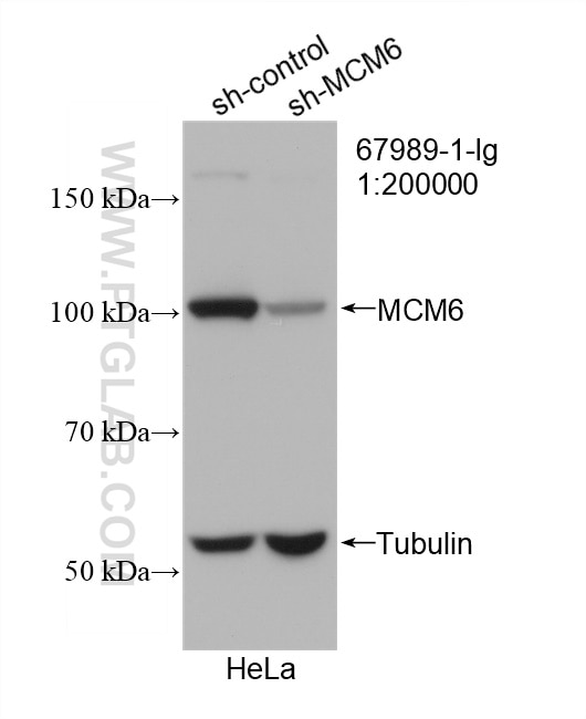 Western Blot (WB) analysis of HeLa cells using MCM6 Monoclonal antibody (67989-1-Ig)
