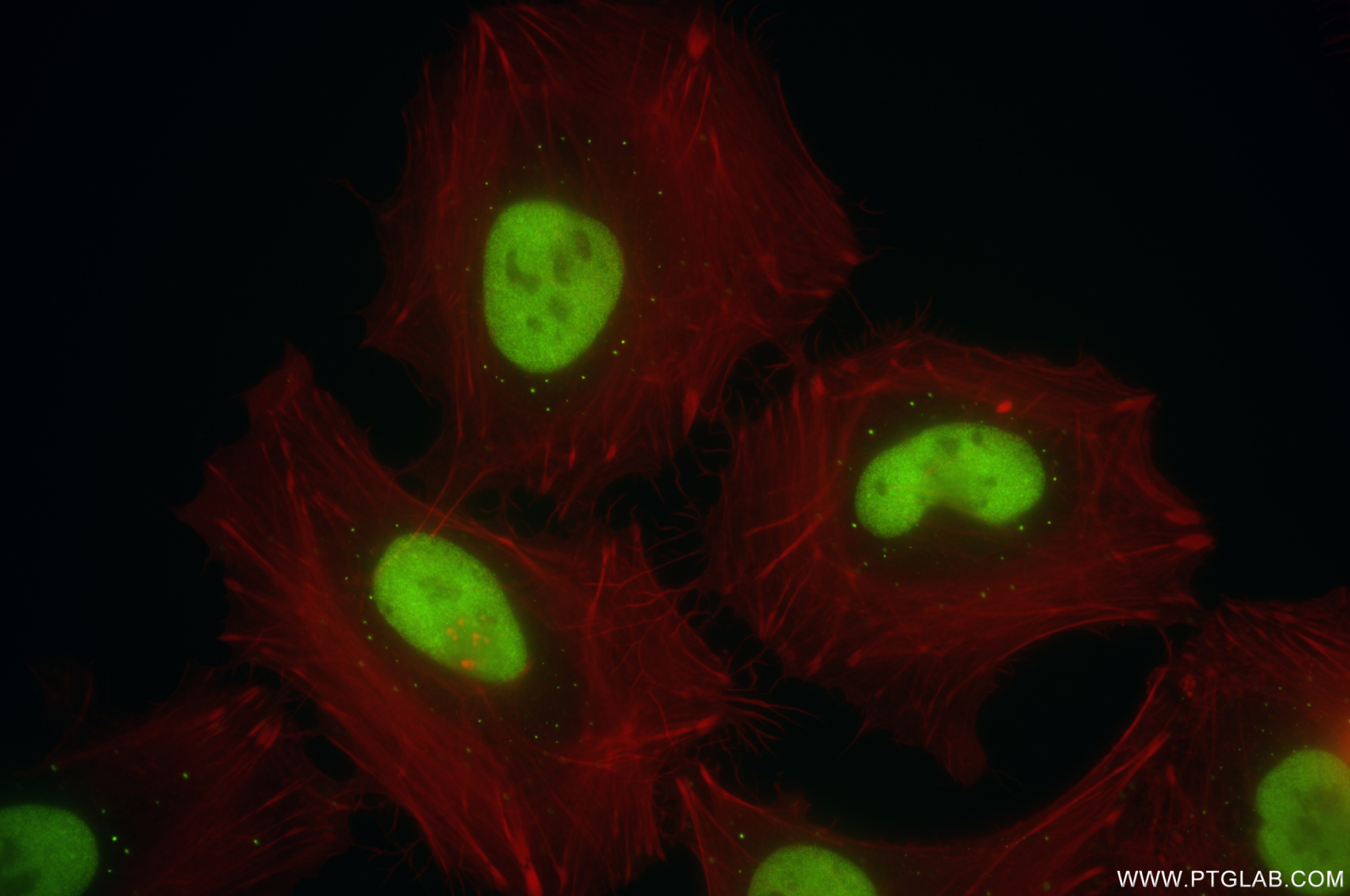 IF Staining of HeLa using 86950-1-RR Immunofluorescence (IF) / fluorescent staining of HeLa cells using MCM6 Recombinant monoclonal antibody (86950-1-RR)