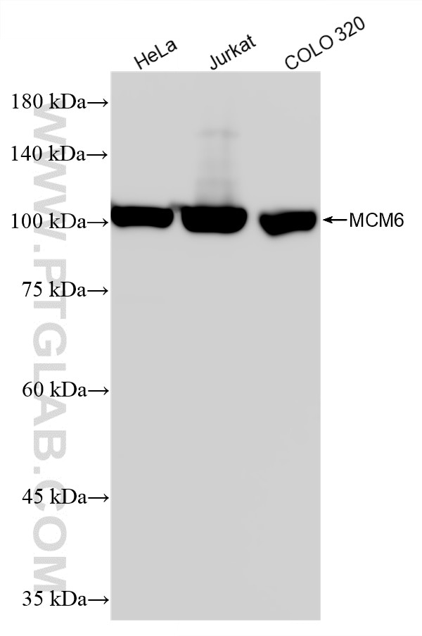 WB analysis using 86950-1-RR Western Blot (WB) analysis of various lysates using MCM6 Recombinant monoclonal antibody (86950-1-RR)