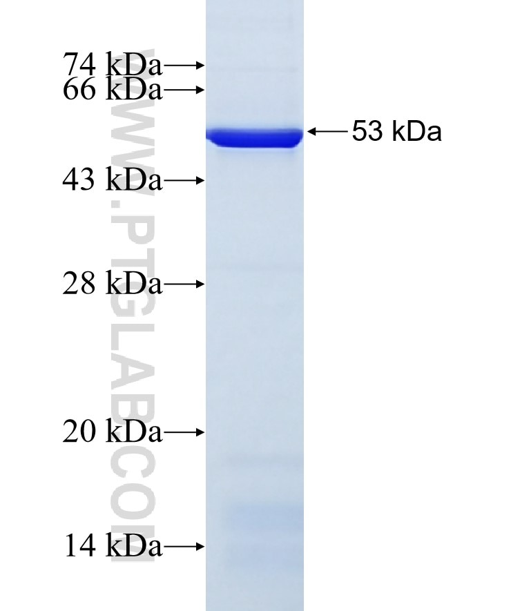 MCM6 fusion protein Ag4354 SDS-PAGE