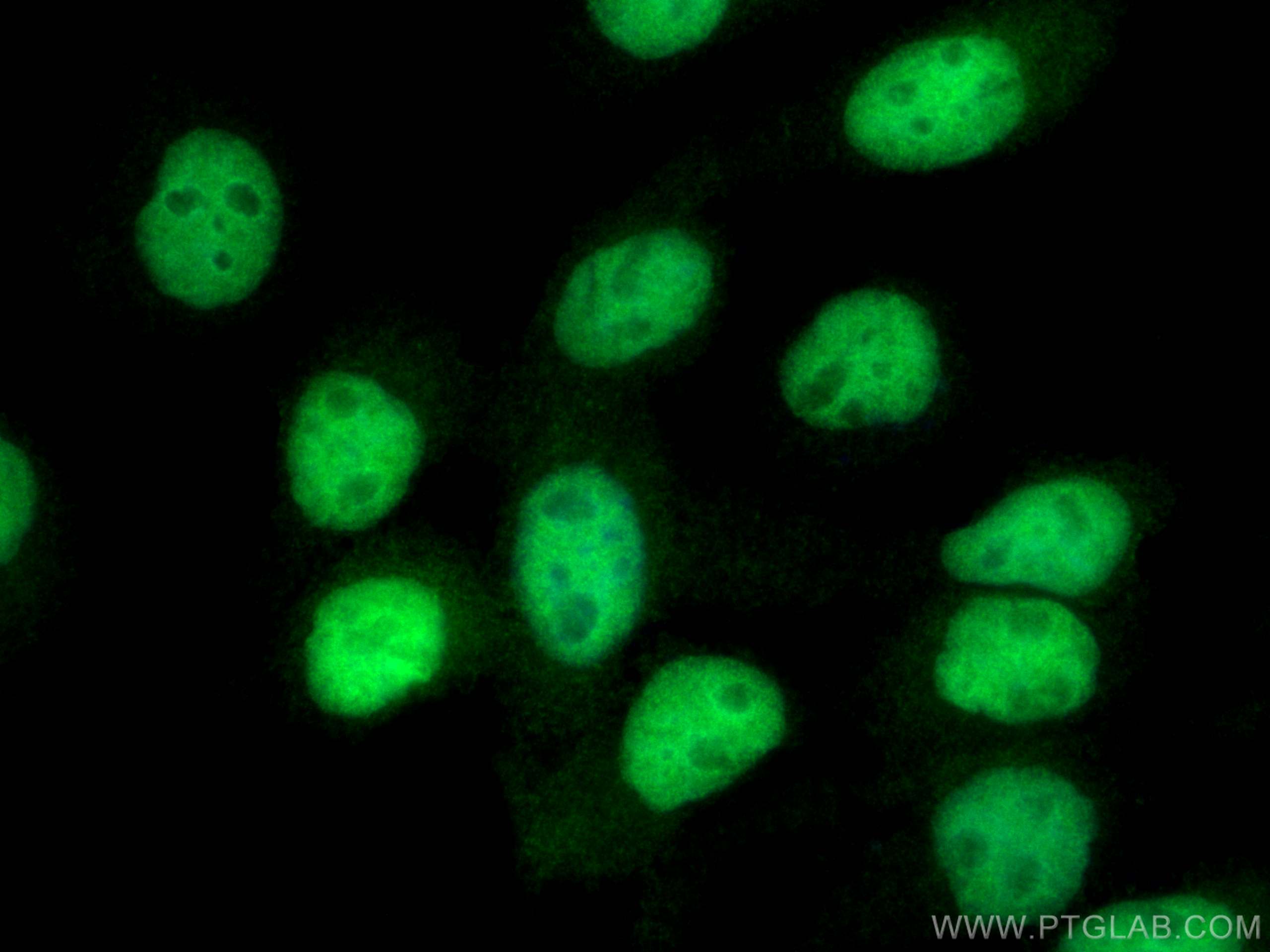 Immunofluorescence (IF) / fluorescent staining of A431 cells using MCM7 Polyclonal antibody (11225-1-AP)