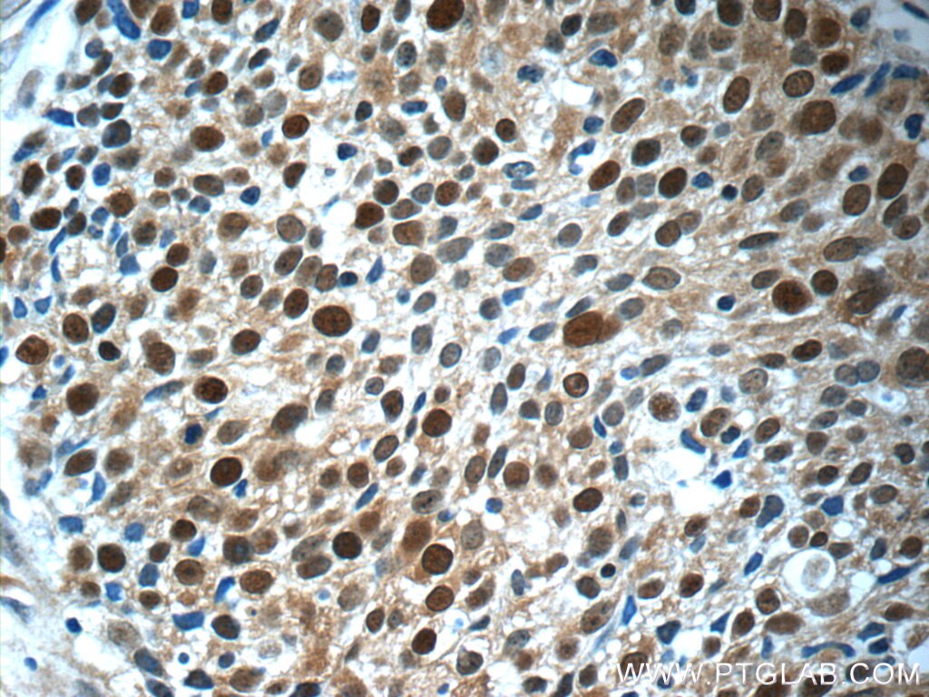 MCM7 Polyclonal antibody