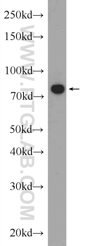 Western Blot (WB) analysis of NIH/3T3 cells using MCM7 Polyclonal antibody (11225-1-AP)