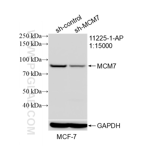 WB result of MCM7 antibody (11225-1-AP; 1:15000; incubated at room temperature for 1.5 hours) with sh-Control and sh-MCM7 transfected MCF-7 cells. Western Blot (WB) analysis of MCF-7 cells using MCM7 Polyclonal antibody (11225-1-AP)