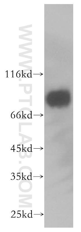 Western Blot (WB) analysis of MCF-7 cells using MCM7 Polyclonal antibody (11225-1-AP)