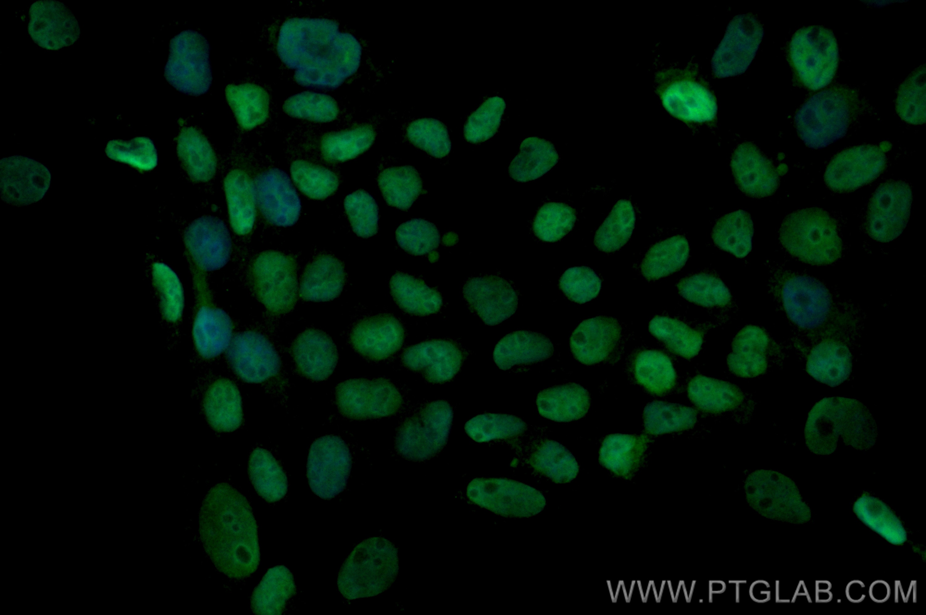 Immunofluorescence (IF) / fluorescent staining of A431 cells using CoraLite® Plus 488-conjugated MCM7 Polyclonal anti (CL488-11225)