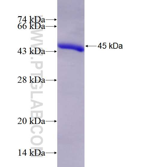 MCM7 fusion protein Ag28558 SDS-PAGE