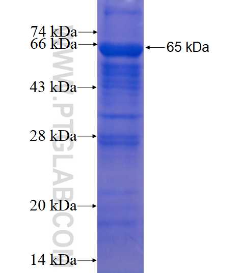 MCM7 fusion protein Ag1730 SDS-PAGE