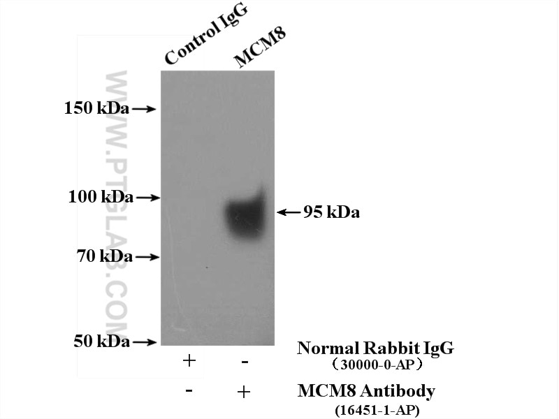 Immunoprecipitation (IP) experiment of NIH/3T3 cells using MCM8 Polyclonal antibody (16451-1-AP)