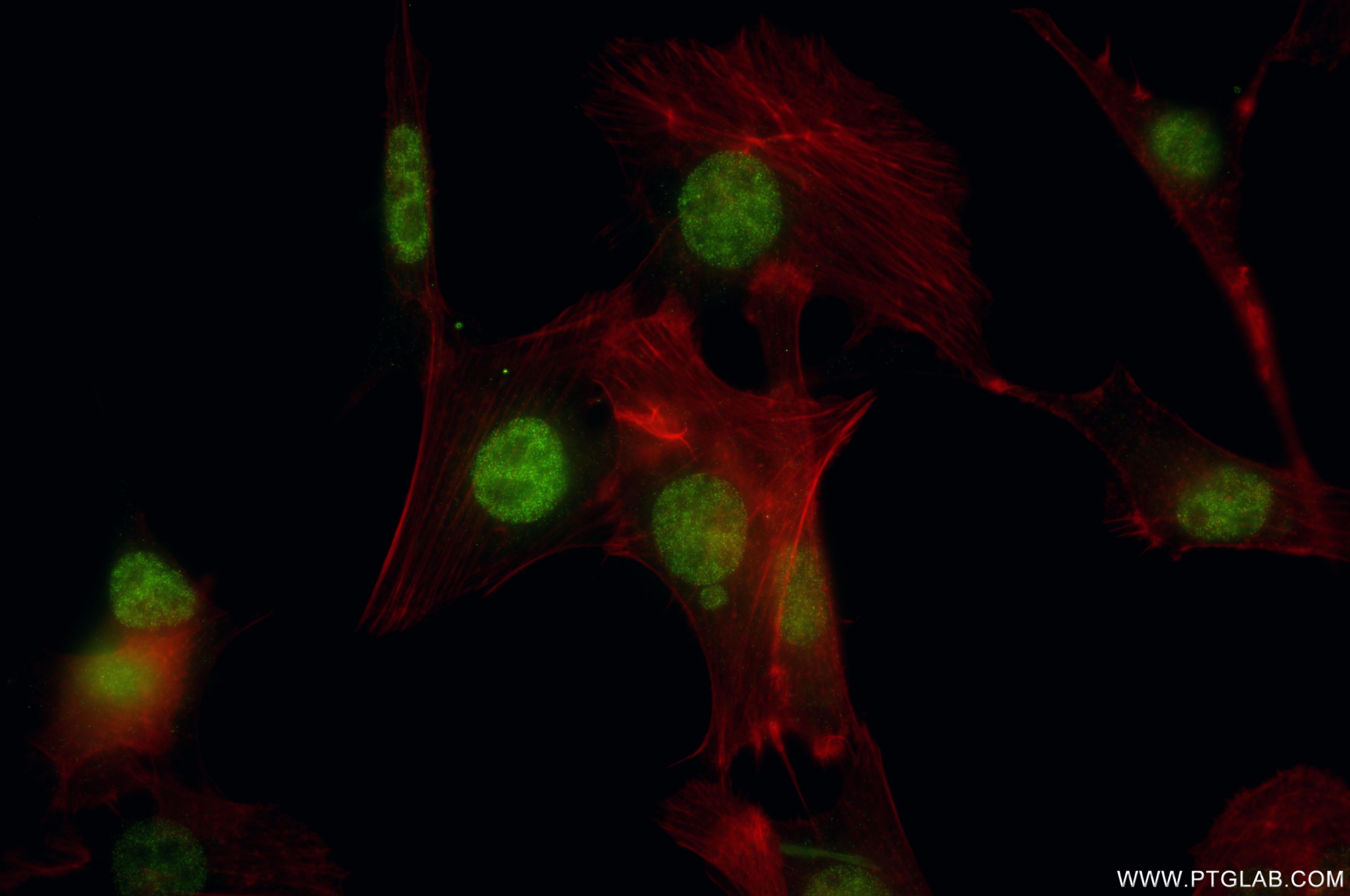Immunofluorescence (IF) / fluorescent staining of NIH/3T3 cells using MCM8 Recombinant monoclonal antibody (87212-1-RR)