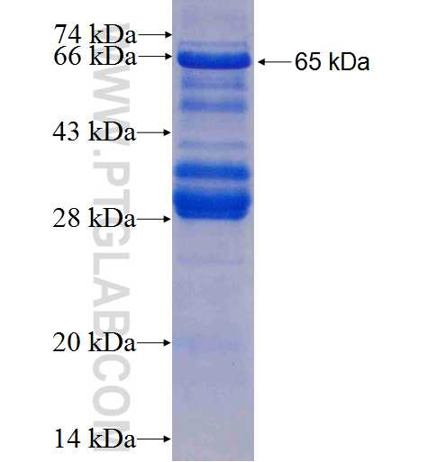 MCM8 fusion protein Ag8696 SDS-PAGE