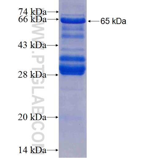 MCM8 fusion protein Ag8696 SDS-PAGE