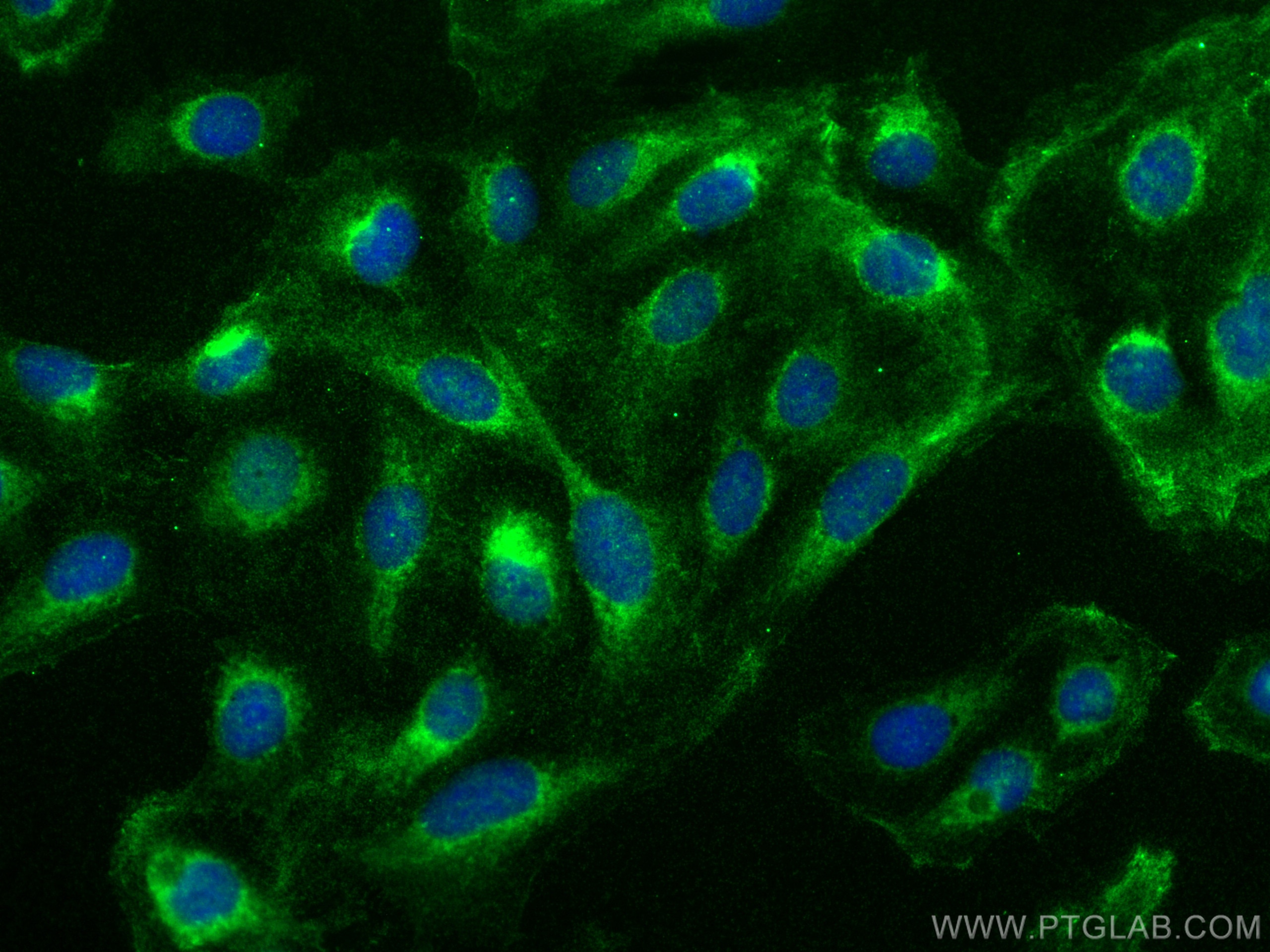 Immunofluorescence (IF) / fluorescent staining of U2OS cells using MCOLN1 Polyclonal antibody (15291-1-AP)