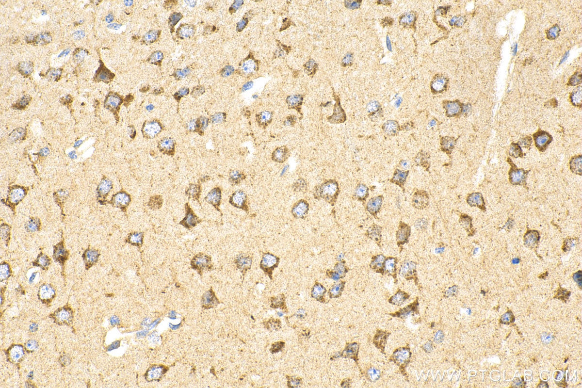 Immunohistochemistry (IHC) staining of mouse brain tissue using MCOLN1 Polyclonal antibody (15291-1-AP)