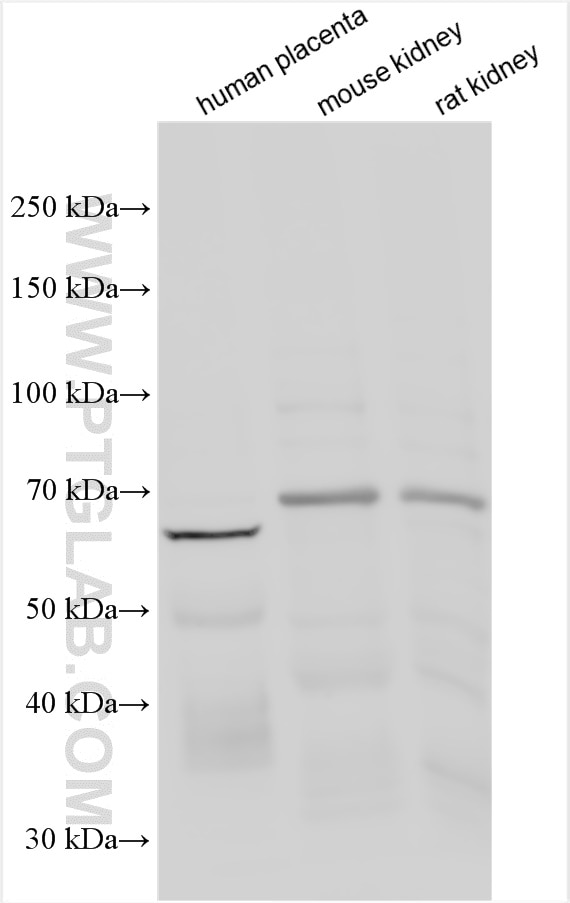 Western Blot (WB) analysis of various lysates using MCOLN1 Polyclonal antibody (15291-1-AP)