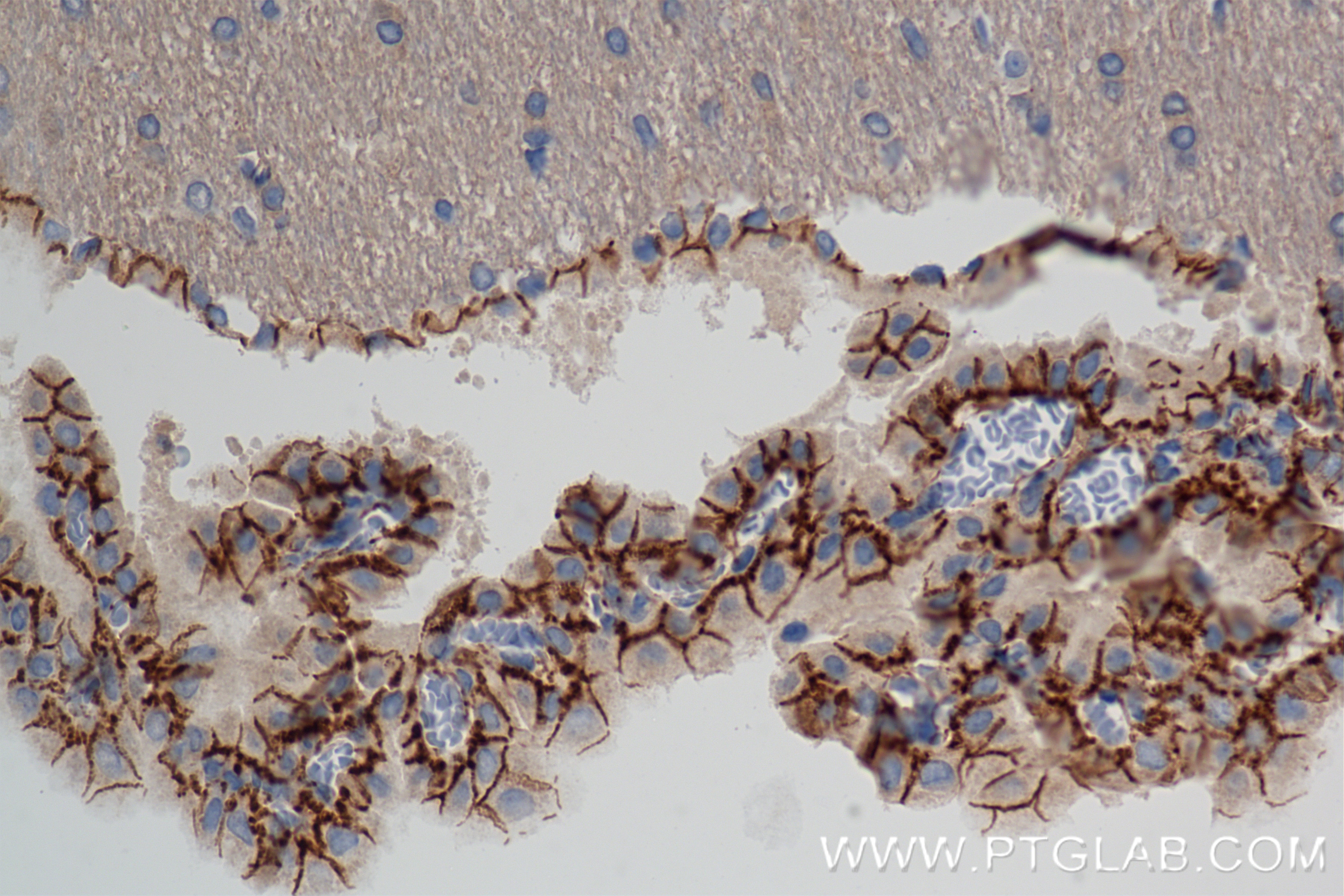Immunohistochemistry (IHC) staining of rat brain tissue using MCOLN1 Recombinant antibody (85339-1-RR)