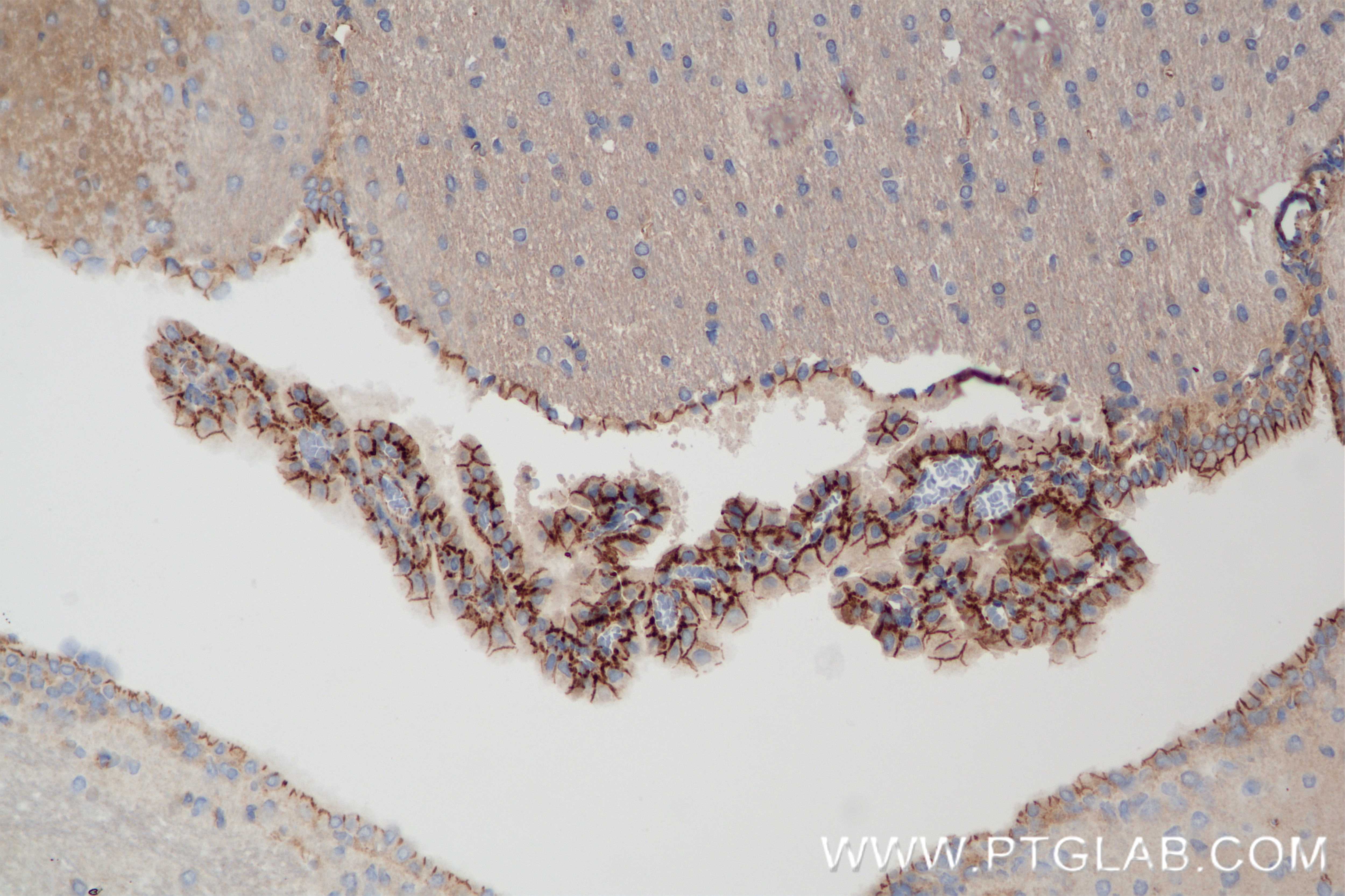 Immunohistochemistry (IHC) staining of rat brain tissue using MCOLN1 Recombinant antibody (85339-1-RR)