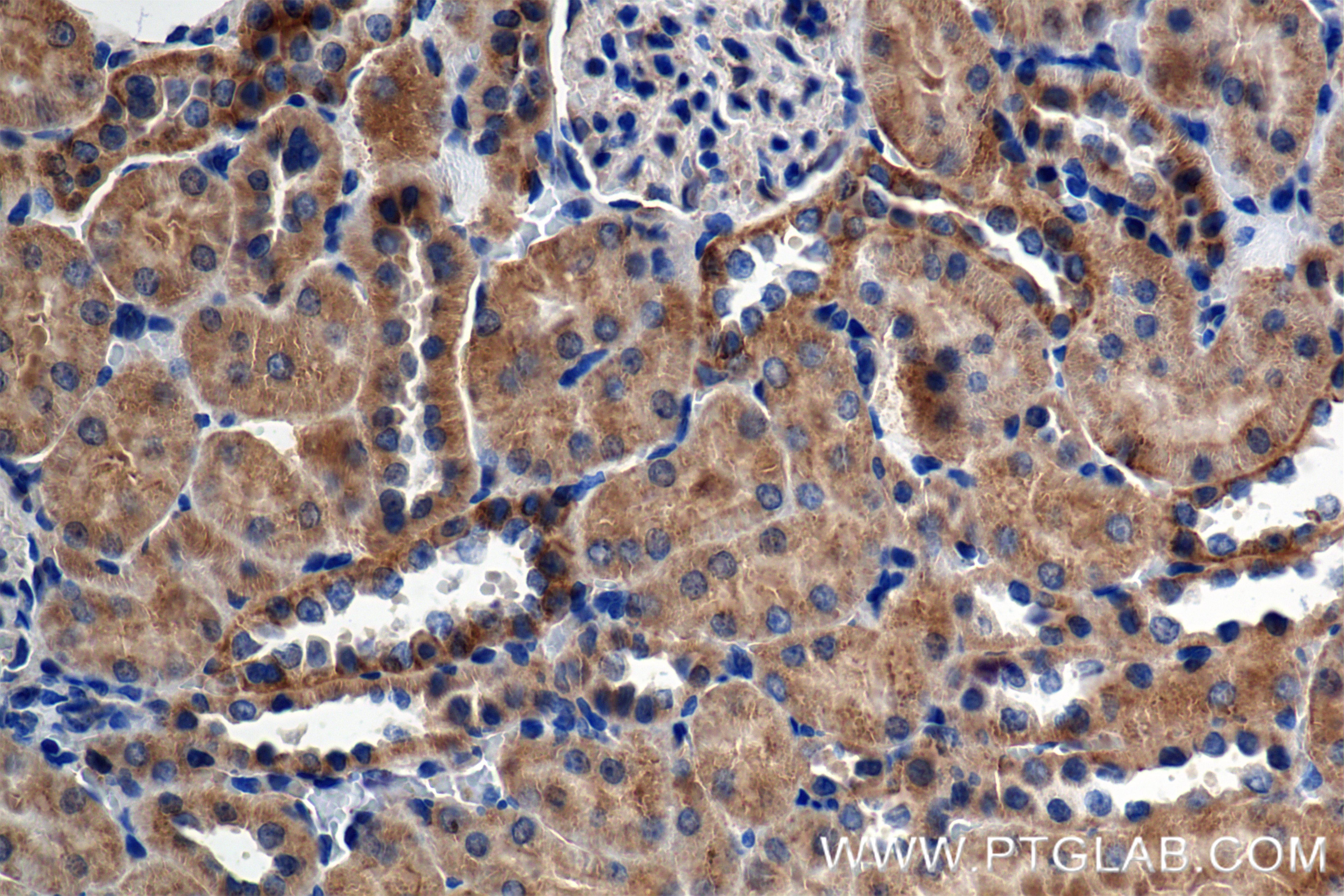 Immunohistochemistry (IHC) staining of rat kidney tissue using MCOLN1 Recombinant antibody (85339-1-RR)