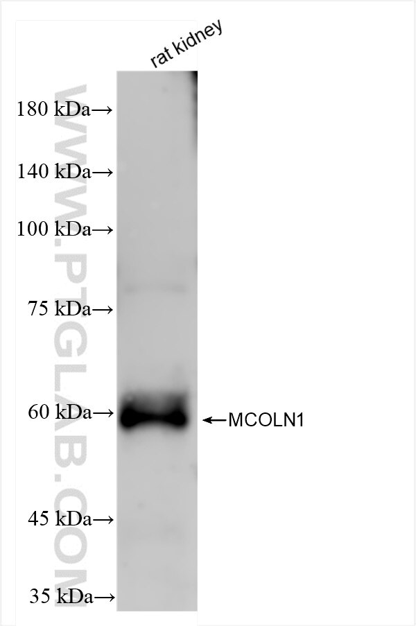 Western Blot (WB) analysis of rat kidney tissue using MCOLN1 Recombinant antibody (85339-1-RR)