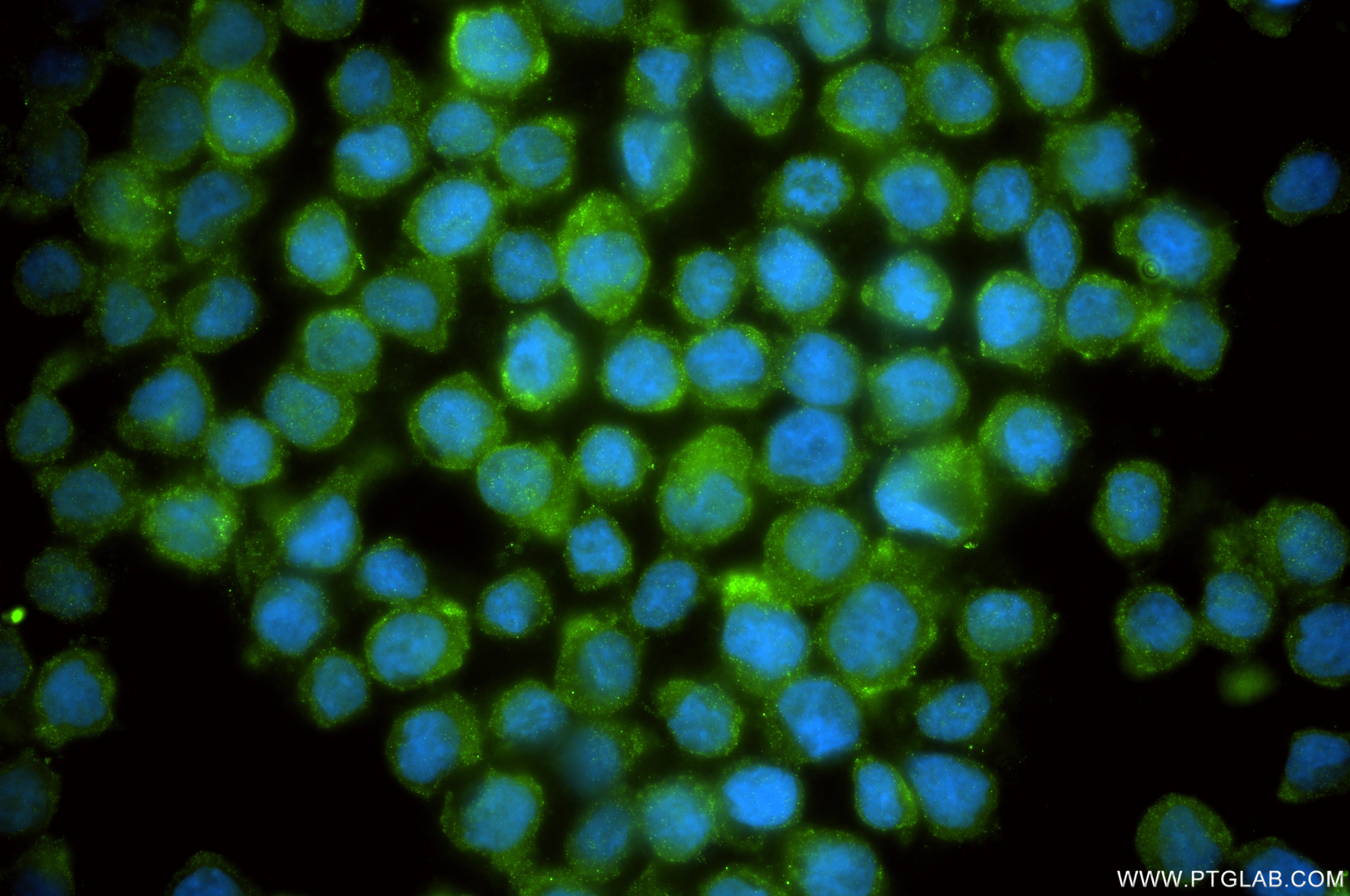 Immunofluorescence (IF) / fluorescent staining of THP-1 cells using Anti-Human MCOLN2 Rabbit Recombinant Antibody (98650-1-RR)