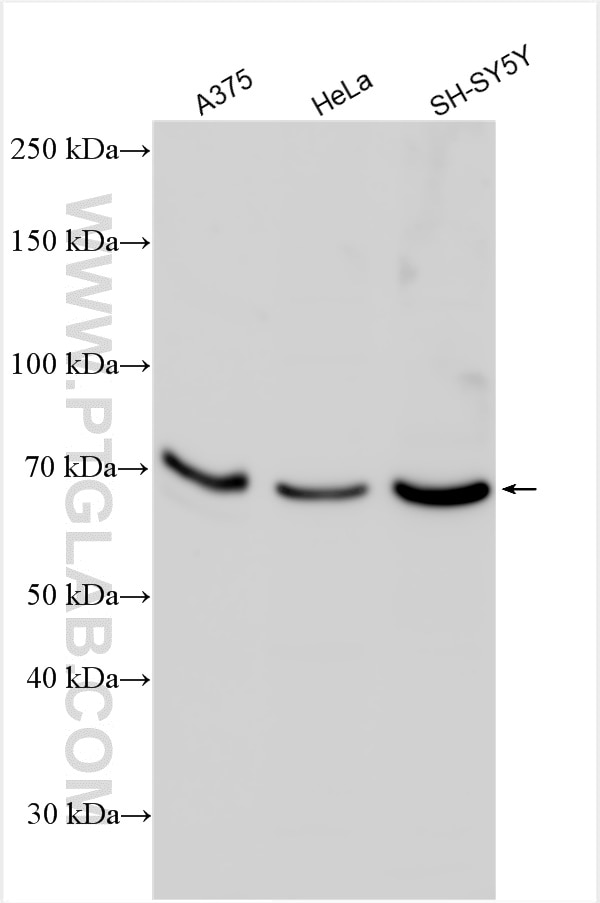 Western Blot (WB) analysis of various lysates using Mucolipin 3 Polyclonal antibody (13879-1-AP)