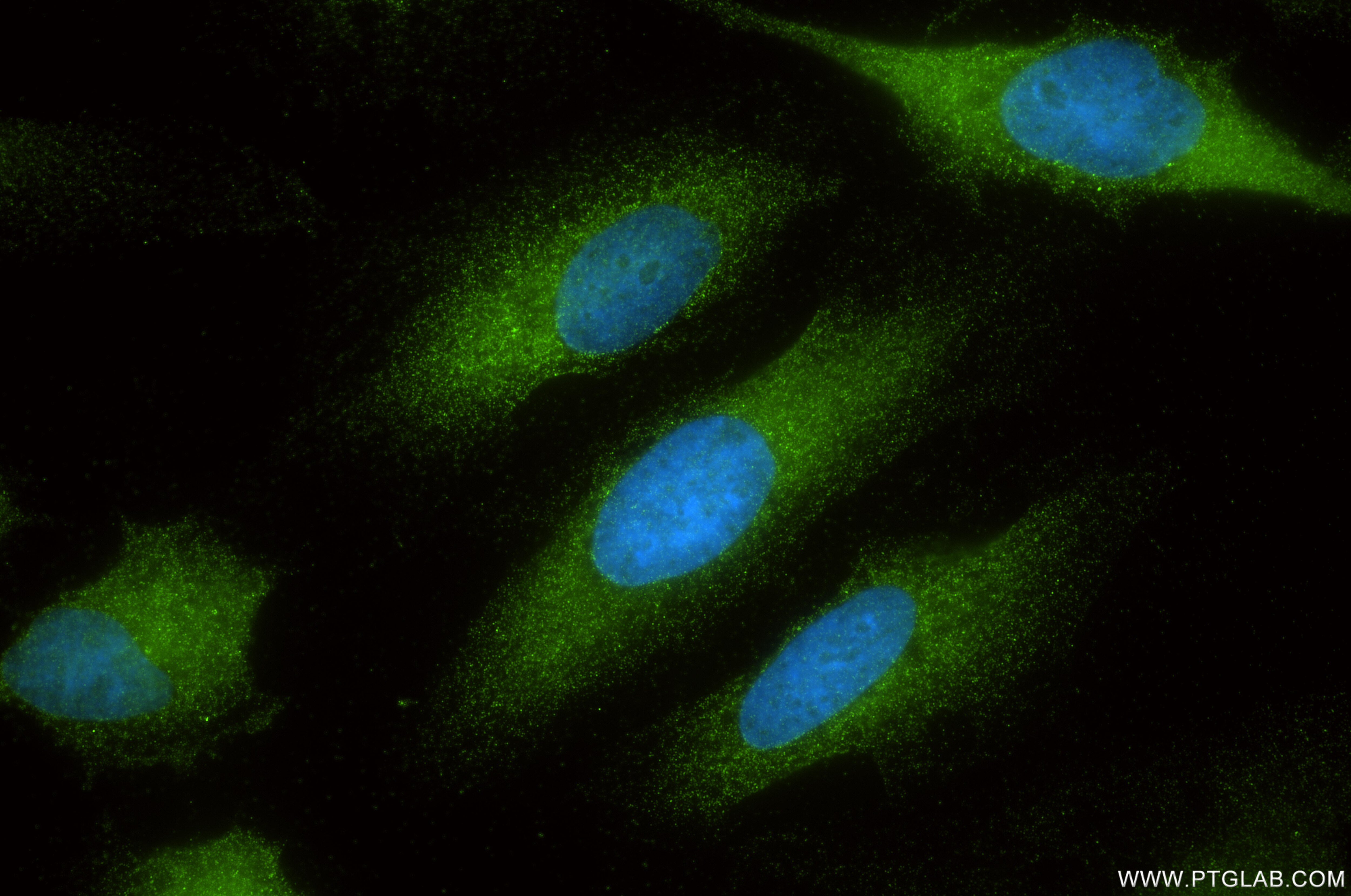 Immunofluorescent analysis of (-20°C Ethanol) fixed HeLa cells using MCOLN3 antibody (86202-1-RR, Clone: 250799F8 ) at dilution of 1:400 and CoraLite®488-Conjugated Goat Anti-Rabbit IgG(H+L) (SA00013-2). Immunofluorescence (IF) / fluorescent staining of HeLa cells using MCOLN3 Recombinant monoclonal antibody (86202-1-RR)