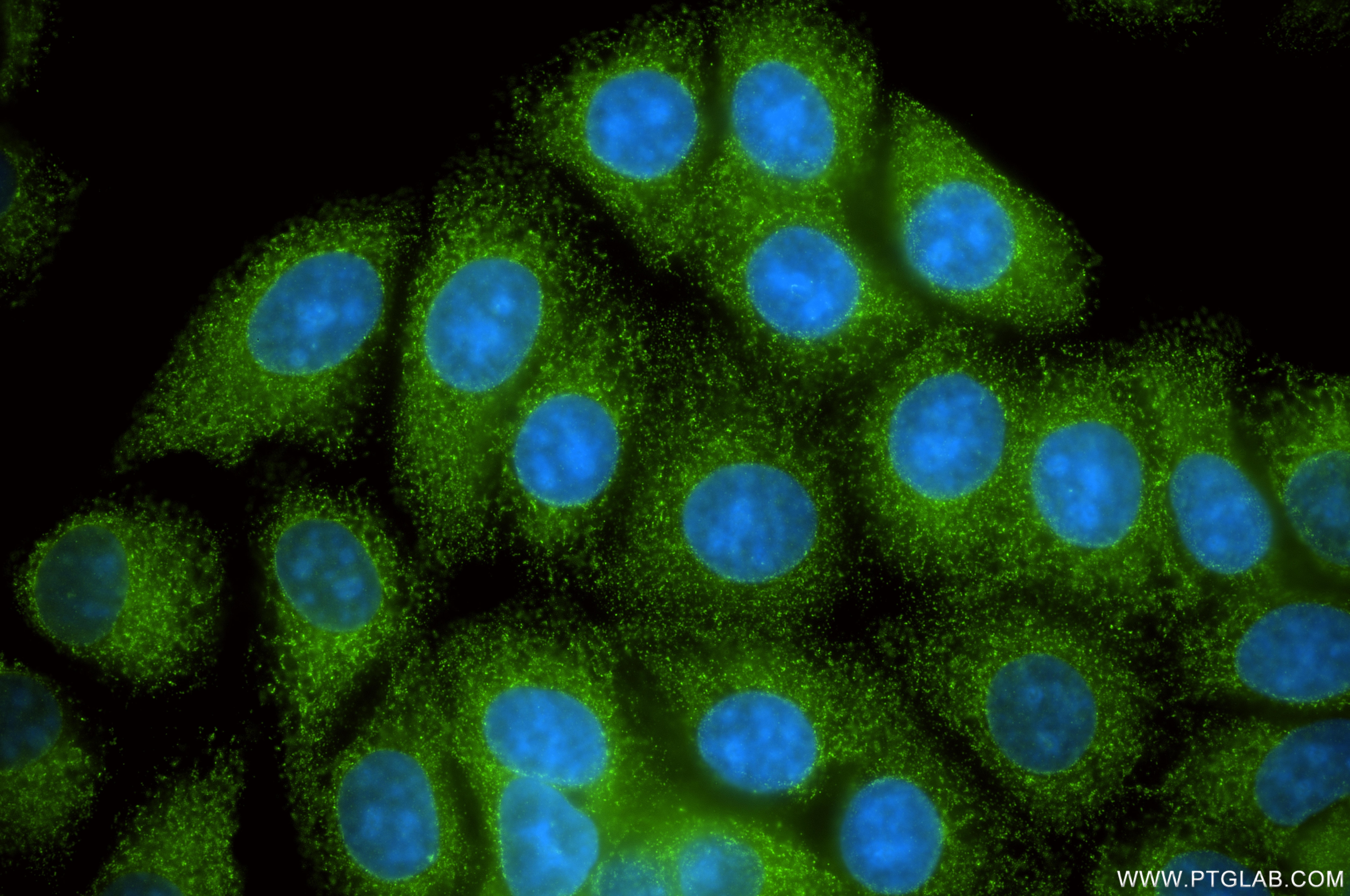 Immunofluorescent analysis of (-20°C Methanol) fixed MCF-7 cells using MCOLN3 antibody (86202-1-RR, Clone: 250799F8 ) at dilution of 1:400 and CoraLite®488-Conjugated Goat Anti-Rabbit IgG(H+L) (SA00013-2). Immunofluorescence (IF) / fluorescent staining of MCF-7 cells using MCOLN3 Recombinant monoclonal antibody (86202-1-RR)