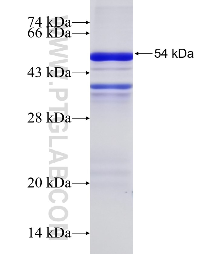MCOLN3 fusion protein Ag4962 SDS-PAGE