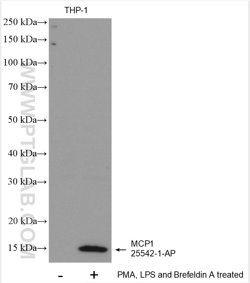 Western Blot (WB) analysis of various lysates using MCP1 Polyclonal antibody (25542-1-AP)