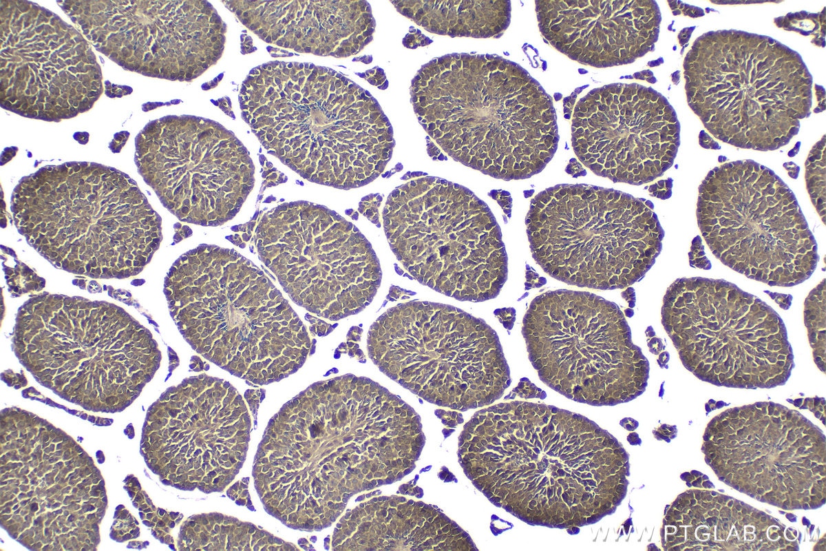 Immunohistochemistry (IHC) staining of mouse testis tissue using MCRS1 Polyclonal antibody (11362-1-AP)