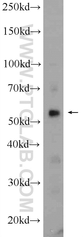 Western Blot (WB) analysis of rat spleen tissue using MCRS1 Polyclonal antibody (11362-1-AP)