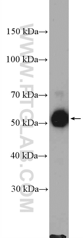 Western Blot (WB) analysis of Jurkat cells using MCRS1 Polyclonal antibody (11362-1-AP)