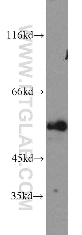 Western Blot (WB) analysis of mouse spleen tissue using MCRS1 Polyclonal antibody (11362-1-AP)