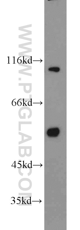 Western Blot (WB) analysis of mouse uterus tissue using MCRS1 Polyclonal antibody (11362-1-AP)