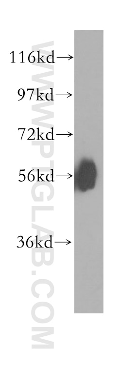 Western Blot (WB) analysis of human spleen tissue using MCRS1 Polyclonal antibody (11362-1-AP)