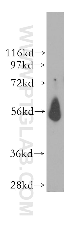 Western Blot (WB) analysis of human brain tissue using MCRS1 Polyclonal antibody (11362-1-AP)