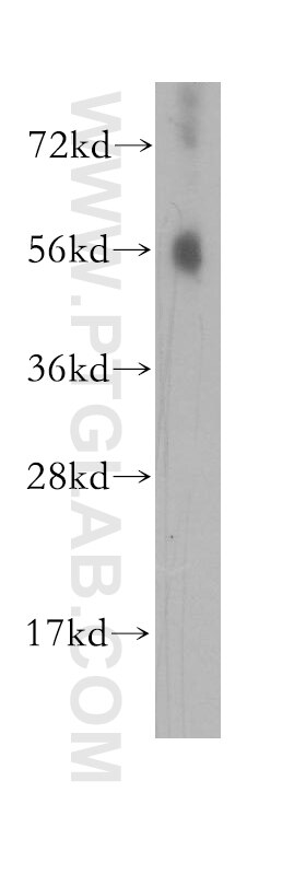 Western Blot (WB) analysis of human liver tissue using MCRS1 Polyclonal antibody (11362-1-AP)