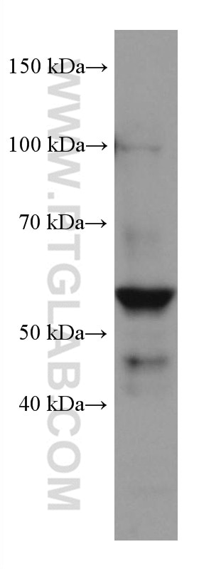 WB analysis of U2OS using 60215-1-Ig
