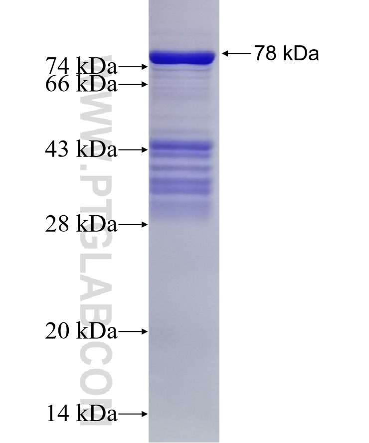 MCRS1 fusion protein Ag1904 SDS-PAGE