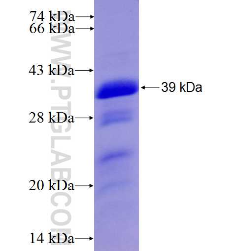 MCSF fusion protein Ag6294 SDS-PAGE