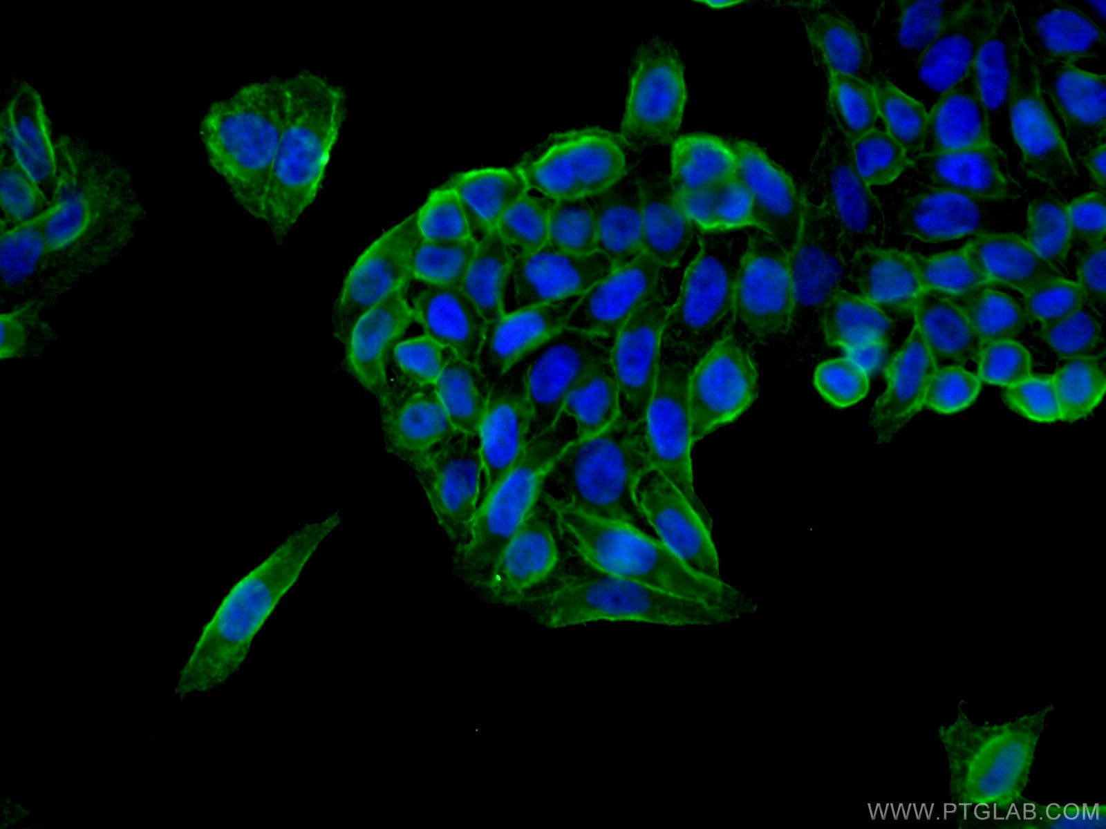 Immunofluorescence (IF) / fluorescent staining of HeLa cells using MCT1 Polyclonal antibody (20139-1-AP)
