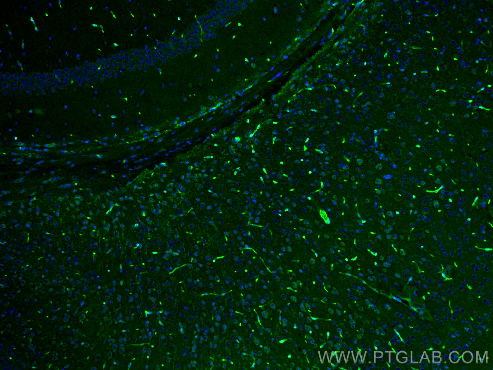 Immunofluorescence (IF) / fluorescent staining of mouse brain tissue using MCT1 Polyclonal antibody (20139-1-AP)