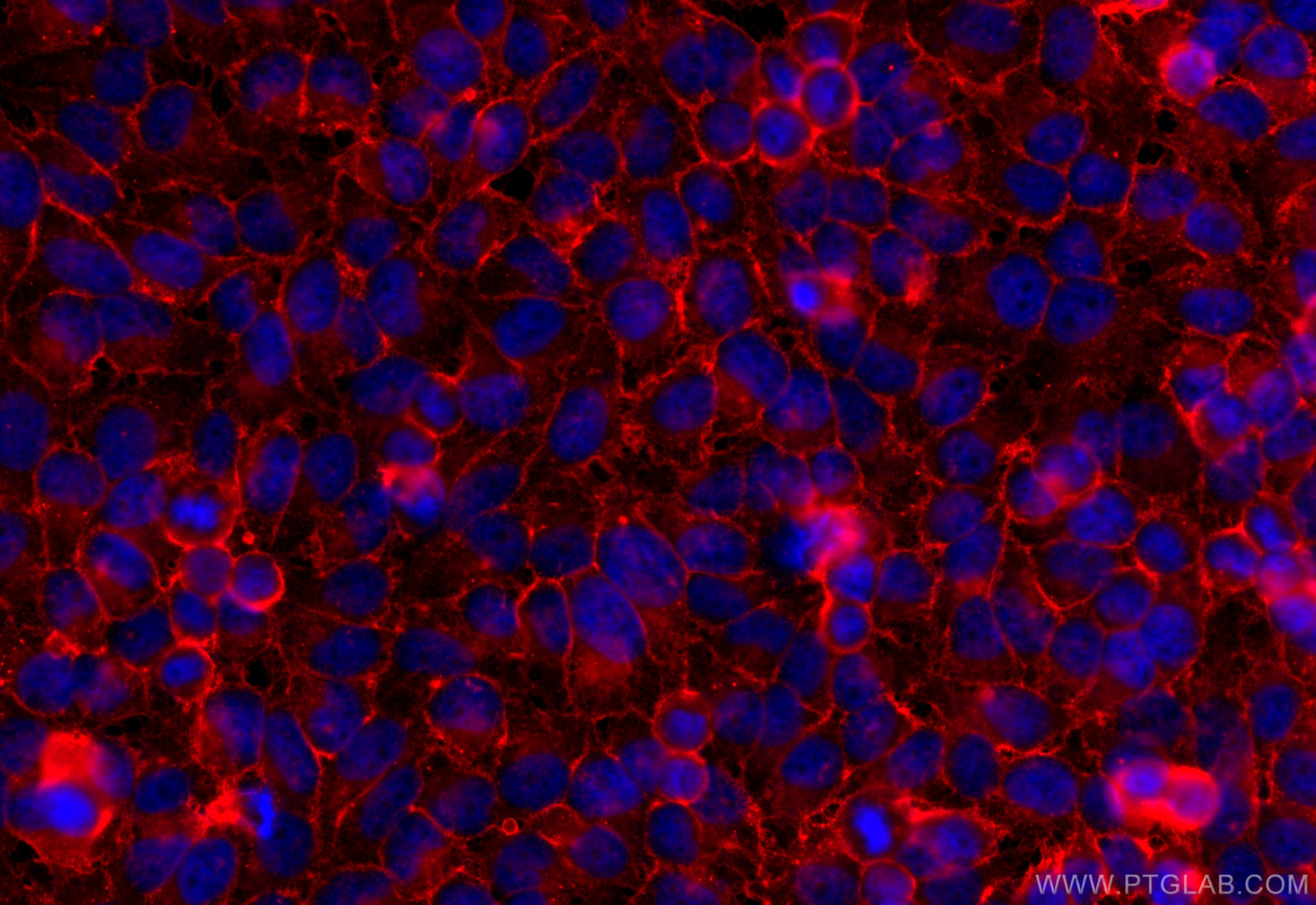 Immunofluorescence (IF) / fluorescent staining of HeLa cells using MCT1 Polyclonal antibody (20139-1-AP)