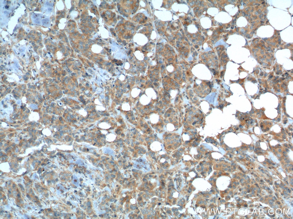 MCT1 Polyclonal antibody