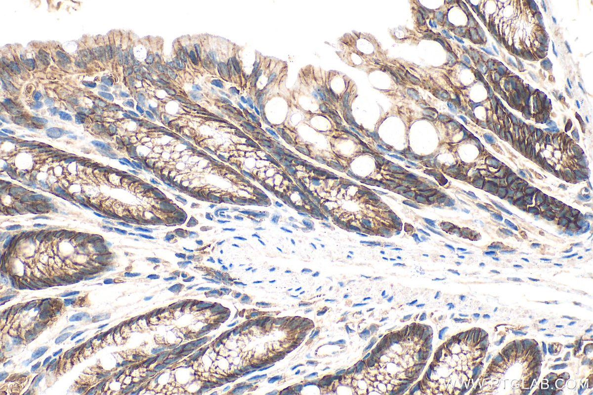 Immunohistochemistry (IHC) staining of mouse colon tissue using MCT1 Polyclonal antibody (20139-1-AP)