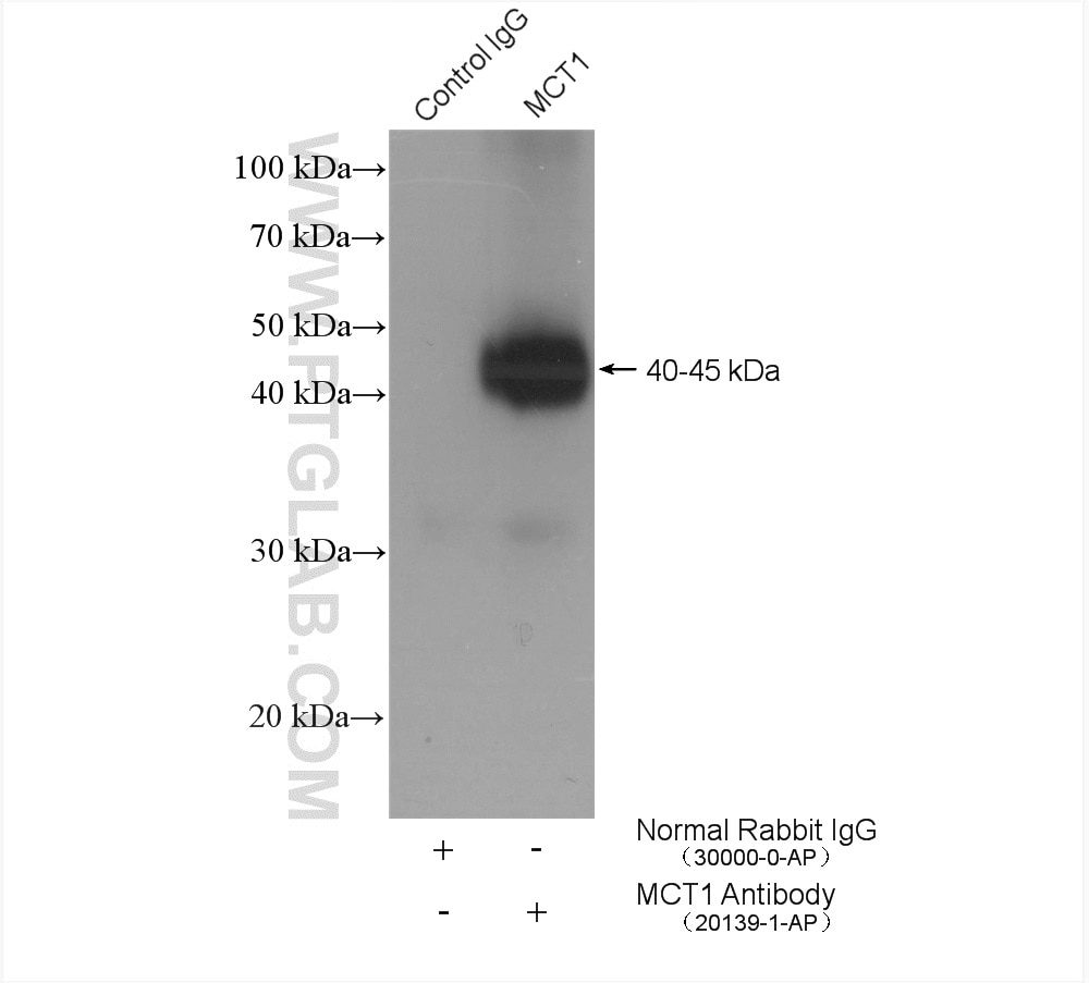 Immunoprecipitation (IP) experiment of Raji cells using MCT1 Polyclonal antibody (20139-1-AP)