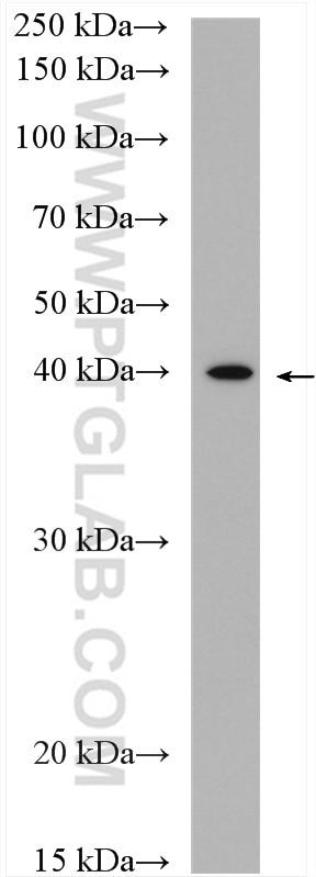 Western Blot (WB) analysis of mouse brain tissue using MCT1 Polyclonal antibody (20139-1-AP)